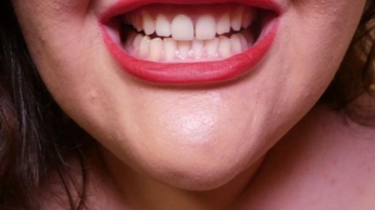 Schönheit in jedem Zahn: scharfe Kanten – (nicht reden)