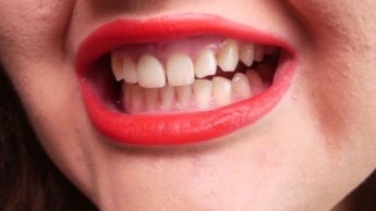 Schönheit in scharfen Zähnen – (kein Reden)