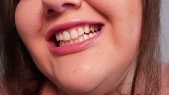 Scharfe Zähne und die Magie der Attraktivität – (nicht reden)